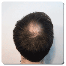 75g - The daily <br><font color="#D1A827">6 months supply</font><!-- The Daily Groom Hair Fibres --><br><strong>FREE Delivery</strong>